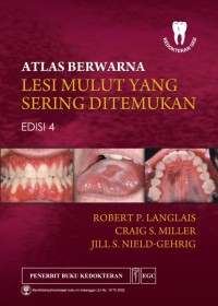 Atlas Berwarna Lesi Mulut yang Sering Ditemukan