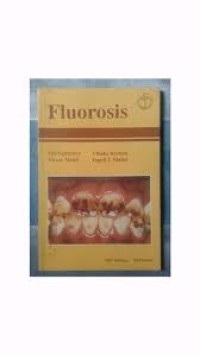 Fluorosis