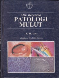 Atlas berwarna Patologi Mulut