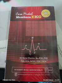 Image of Cara Membaca EKG