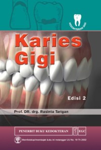 Karies Gigi