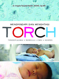 Image of Menghindari Dan Mengatasi Torch