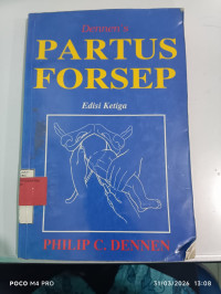 Image of Partus Forsep