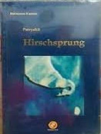 Image of Penyakit Hirschsprung