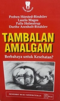 Image of Tambalan Amalgam Berbahaya Untuk Kesehatan ?